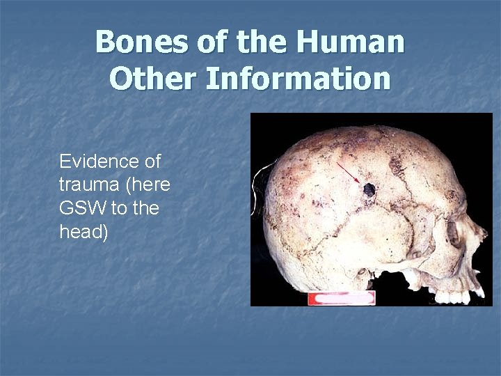 Bones of the Human Other Information Evidence of trauma (here GSW to the head) Bones of the Human Other Information Evidence of trauma (here GSW to the head)