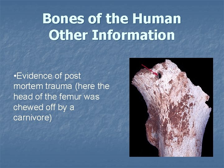 Bones of the Human Other Information • Evidence of post mortem trauma (here the Bones of the Human Other Information • Evidence of post mortem trauma (here the