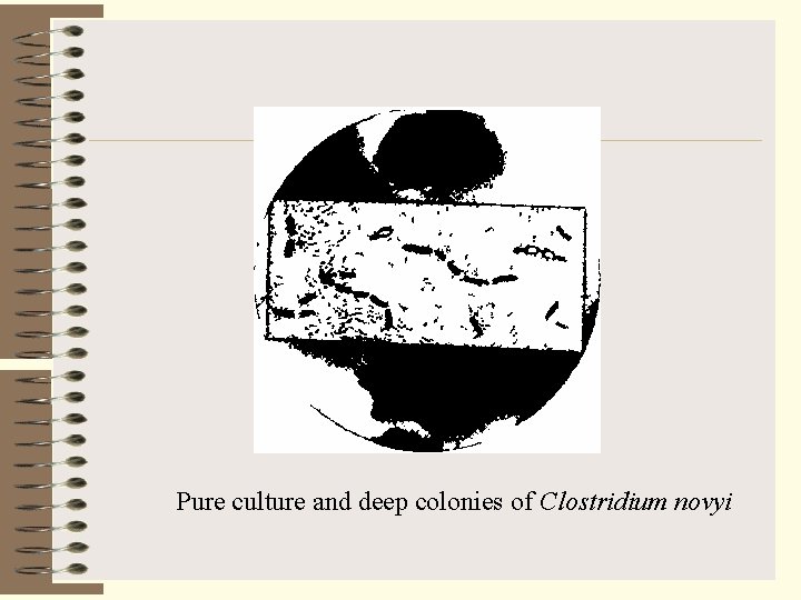 Pure culture and deep colonies of Clostridium novyi 