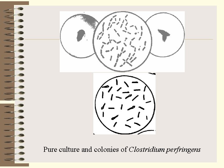 Pure culture and colonies of Clostridium perfringens 