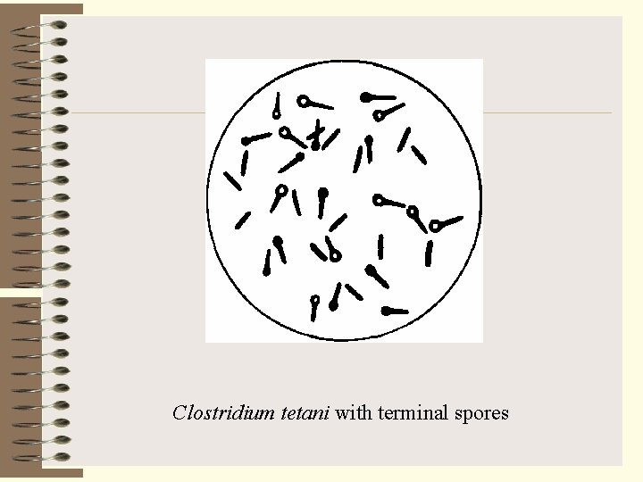 Clostridium tetani with terminal spores 