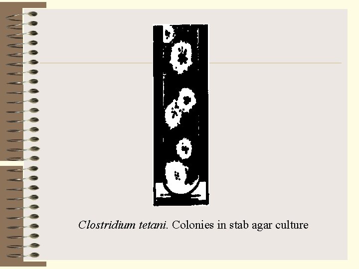 Clostridium tetani. Colonies in stab agar culture 