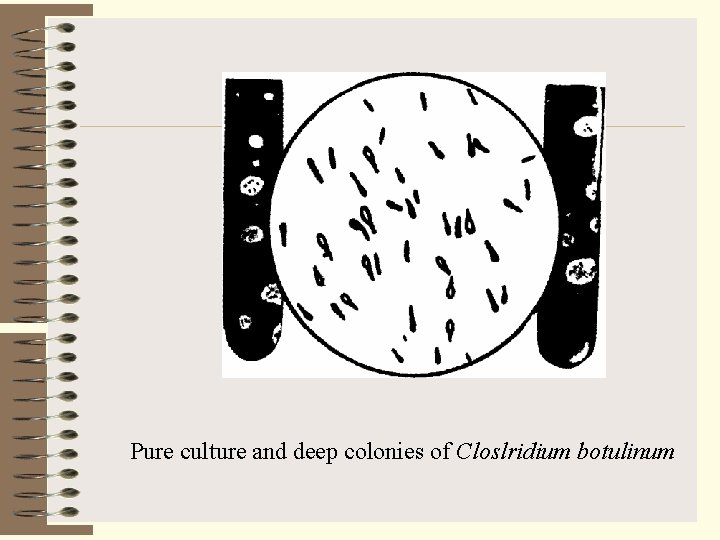 Pure culture and deep colonies of Closlridium botulinum 