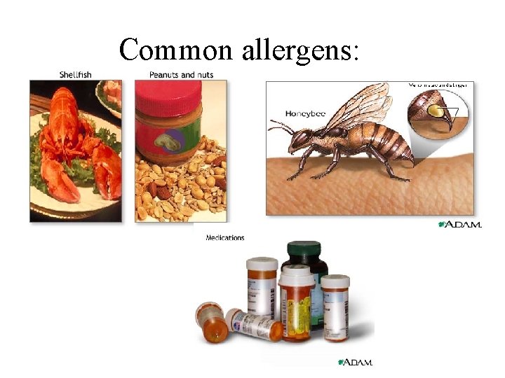 Common allergens: 