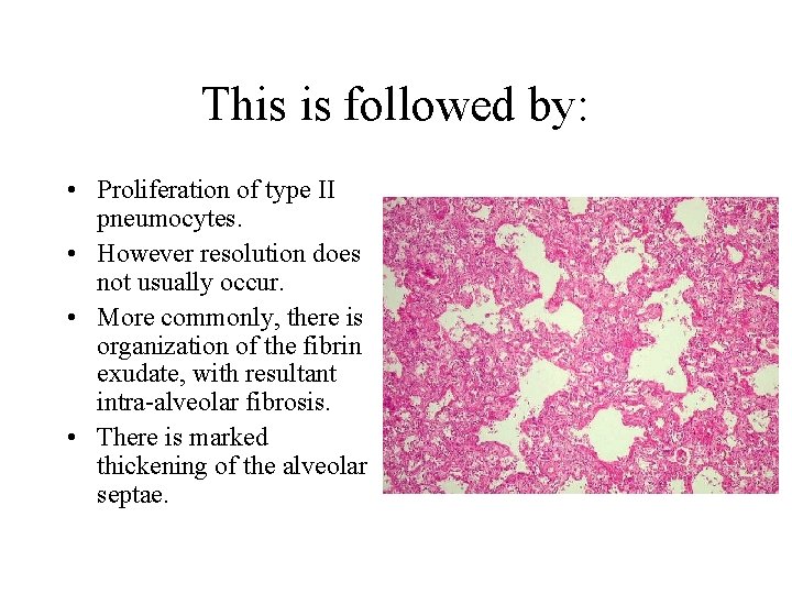 This is followed by: • Proliferation of type II pneumocytes. • However resolution does