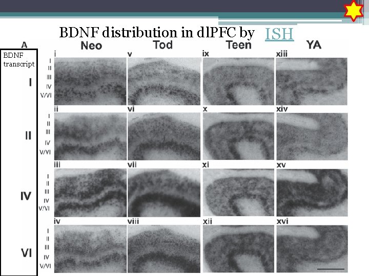 BDNF distribution in dl. PFC by ISH BDNF transcript 