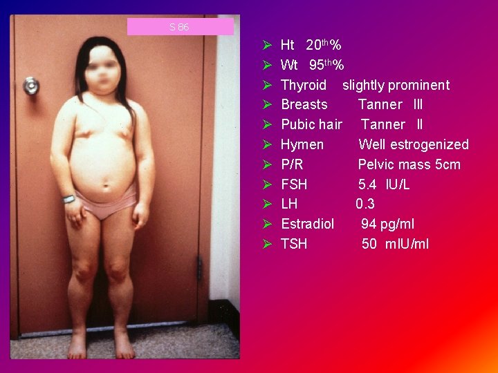 S 86 Ø Ø Ø Ht 20 th% Wt 95 th% Thyroid slightly prominent