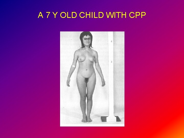 A 7 Y OLD CHILD WITH CPP 