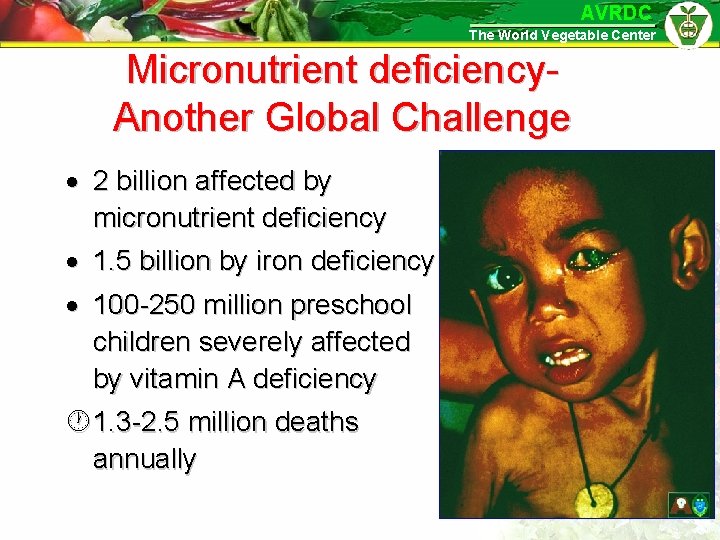 AVRDC The World Vegetable Center Micronutrient deficiency. Another Global Challenge · 2 billion affected