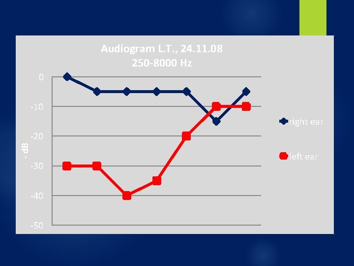 Audiogram L. T. , 24. 11. 08 250 -8000 Hz 0 -10 right ear