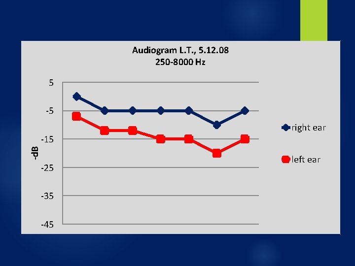 Audiogram L. T. , 5. 12. 08 250 -8000 Hz 5 -5 -d. B