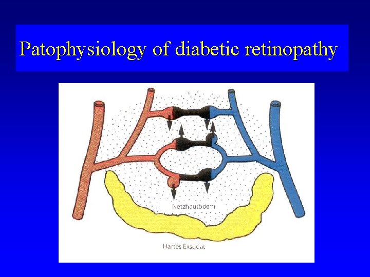Patophysiology of diabetic retinopathy 