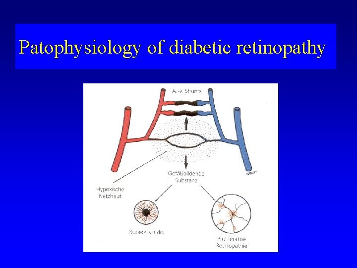 Patophysiology of diabetic retinopathy 