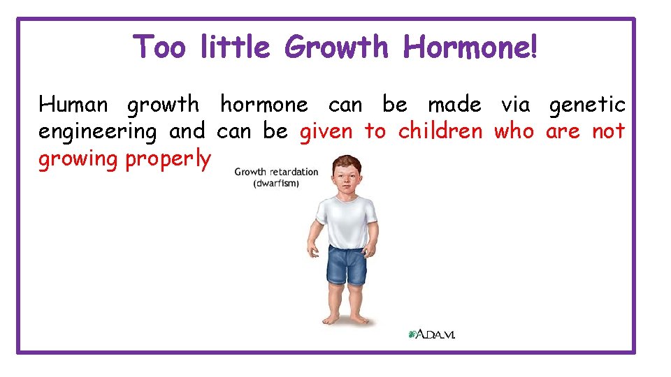 Too little Growth Hormone! Human growth hormone can be made via genetic engineering and