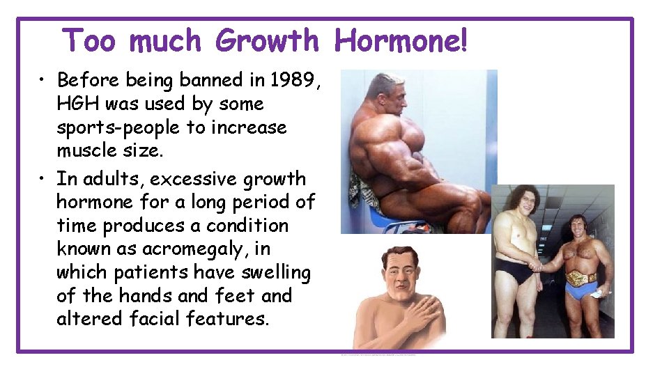 Too much Growth Hormone! • Before being banned in 1989, HGH was used by