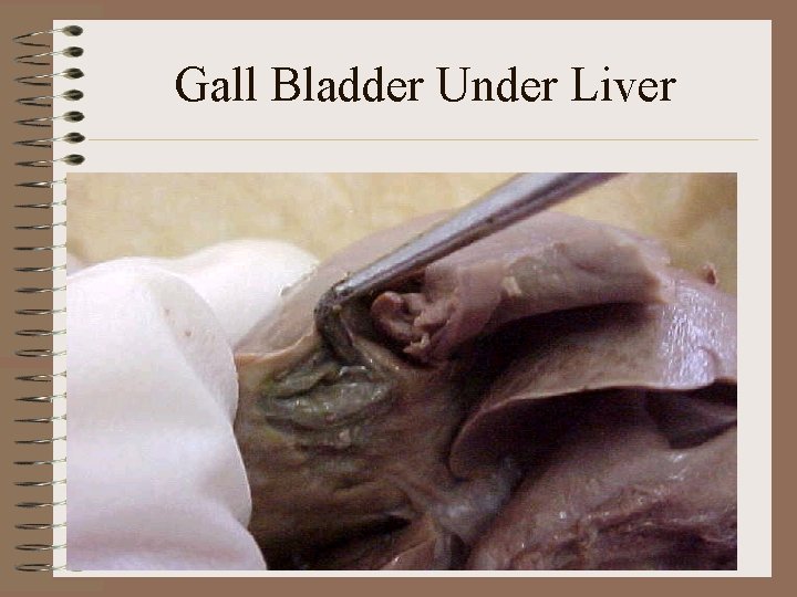 Gall Bladder Under Liver 
