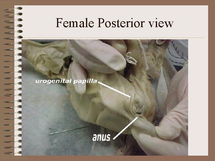 Female Posterior view 
