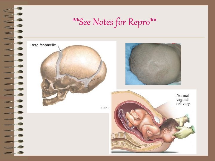  **See Notes for Repro** 