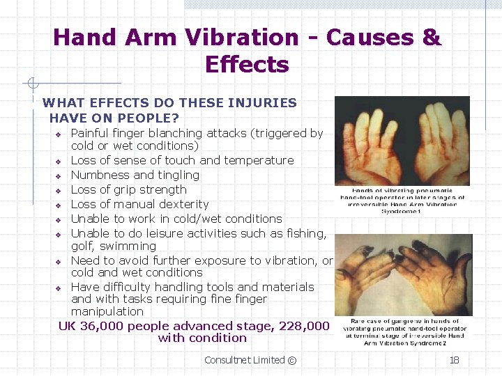 Hand Arm Vibration - Causes & Effects ) WHAT EFFECTS DO THESE INJURIES HAVE