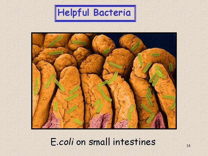  Helpful Bacteria E. coli on small intestines 14 