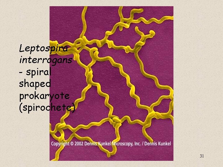 Leptospira interrogans - spiral shaped prokaryote (spirochete) 31 