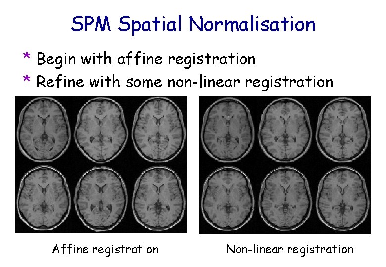 SPM Spatial Normalisation * Begin with affine registration * Refine with some non-linear registration