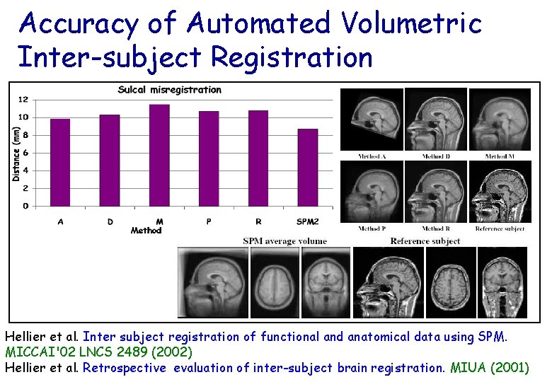 Accuracy of Automated Volumetric Inter-subject Registration Hellier et al. Inter subject registration of functional
