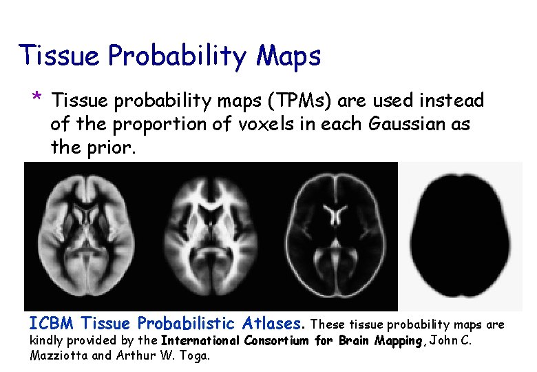 Tissue Probability Maps * Tissue probability maps (TPMs) are used instead of the proportion