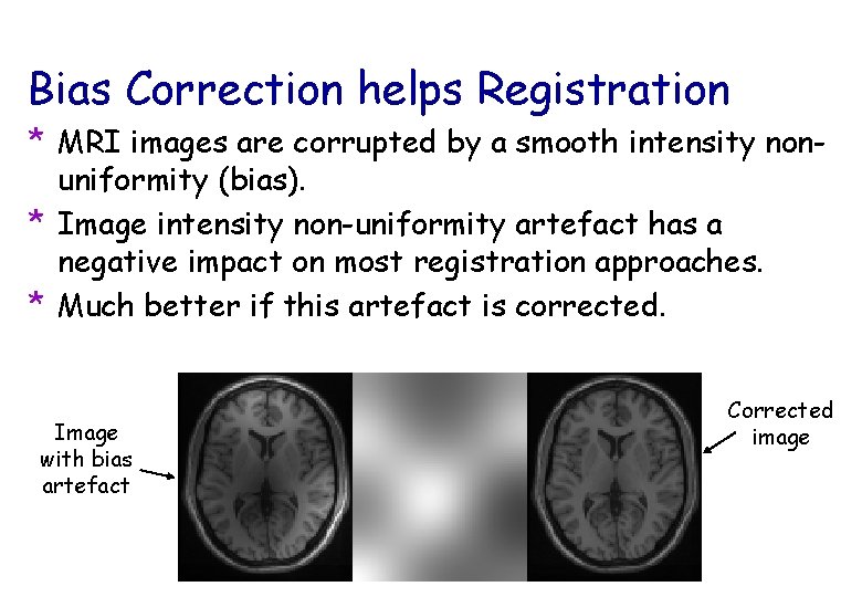 Bias Correction helps Registration * MRI images are corrupted by a smooth intensity nonuniformity