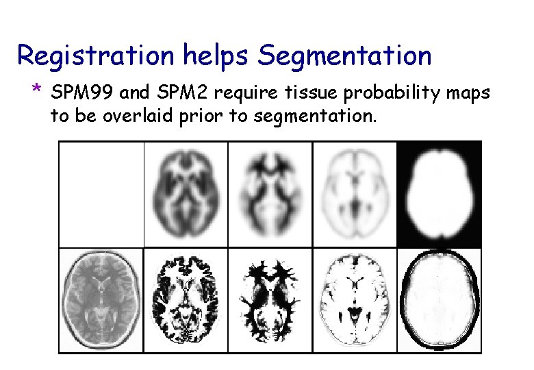 Registration helps Segmentation * SPM 99 and SPM 2 require tissue probability maps to