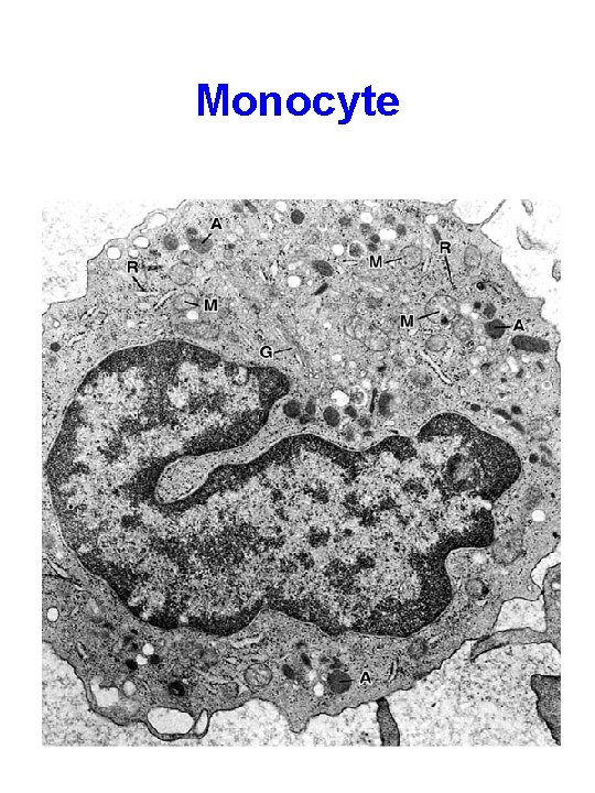 Monocyte 