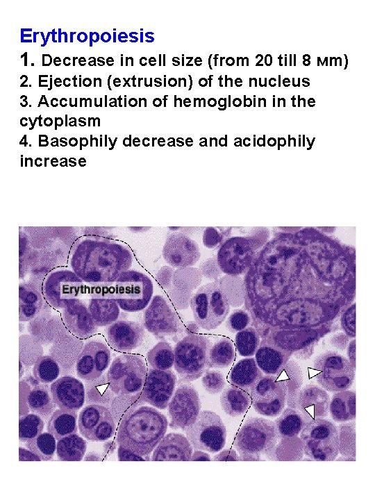 Erythropoiesis 1. Decrease in cell size (from 20 till 8 мm) 2. Ejection (extrusion)