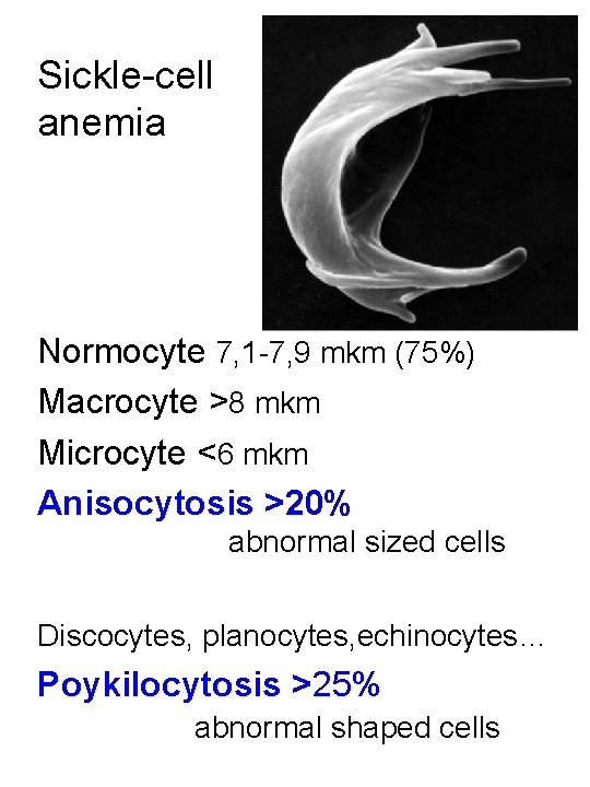 Sickle-cell anemia Normocyte 7, 1 -7, 9 mkm (75%) Macrocyte >8 mkm Microcyte <6