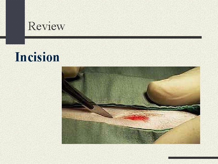 Review Incision 