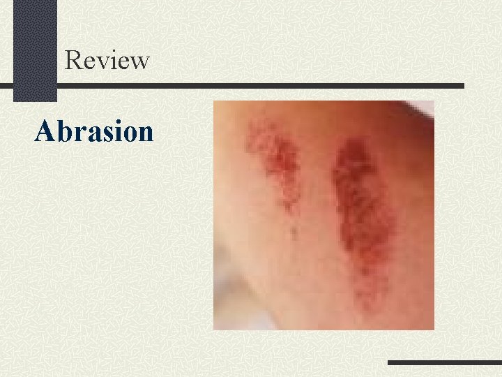 Review Abrasion 