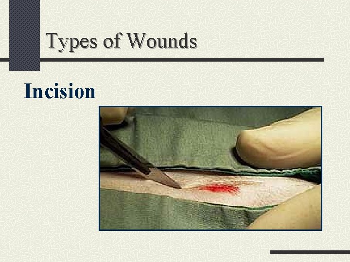 Types of Wounds Incision 
