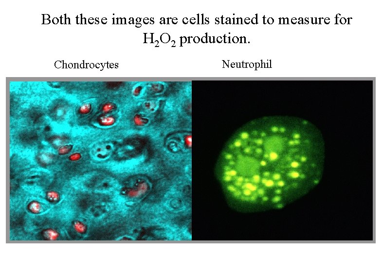 Both these images are cells stained to measure for H 2 O 2 production.