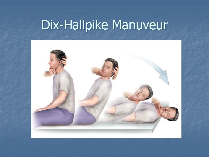 Dix-Hallpike Manuveur 