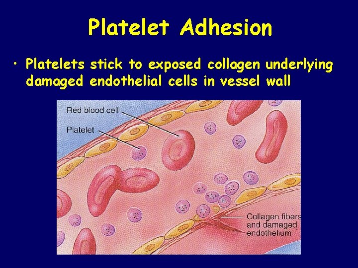 Platelet Adhesion • Platelets stick to exposed collagen underlying damaged endothelial cells in vessel