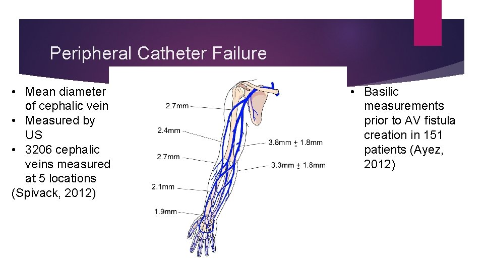 Peripheral Catheter Failure • Mean diameter of cephalic vein • Measured by US •