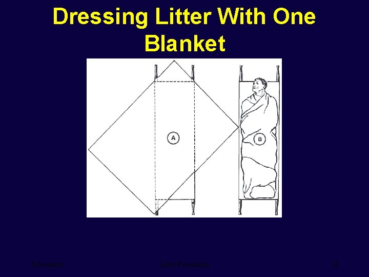 Dressing Litter With One Blanket Evacuation Litter Evacuation 18 