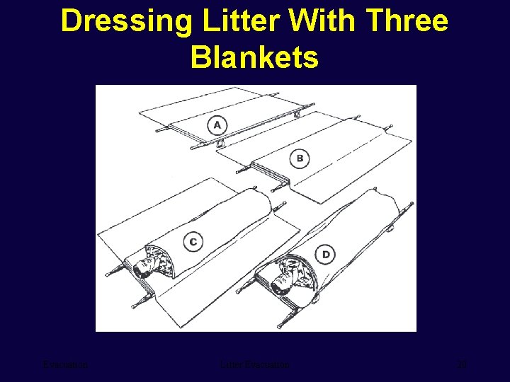 Dressing Litter With Three Blankets Evacuation Litter Evacuation 20 