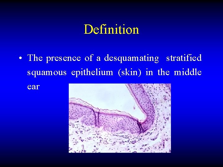 Definition • The presence of a desquamating stratified squamous epithelium (skin) in the middle