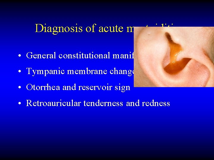 Diagnosis of acute mastoiditis • General constitutional manifestations • Tympanic membrane changes • Otorrhea