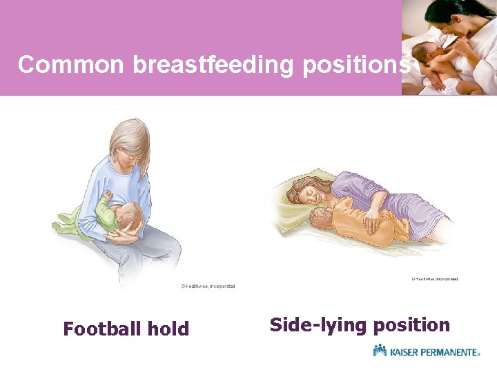 Common breastfeeding positions Football hold Side-lying position 