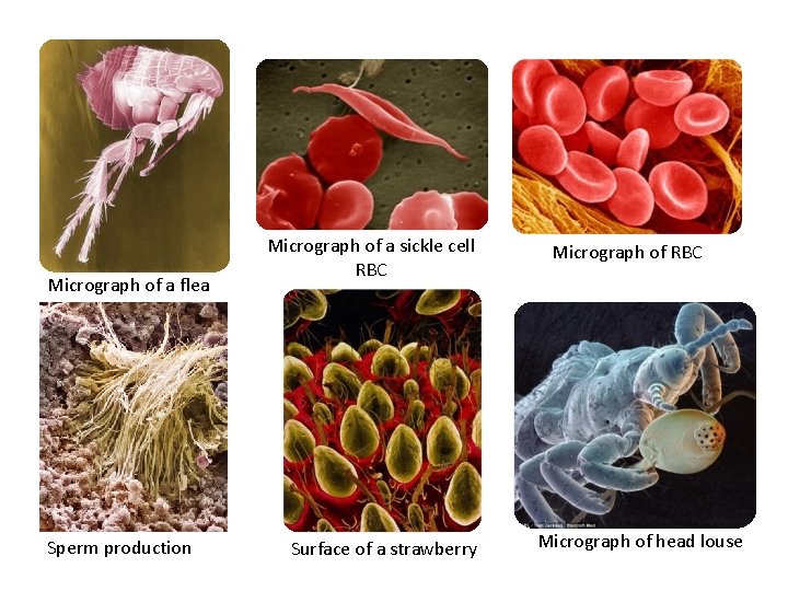 Micrograph of a flea Sperm production Micrograph of a sickle cell RBC Surface of