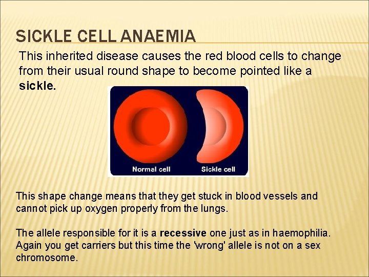 SICKLE CELL ANAEMIA This inherited disease causes the red blood cells to change from