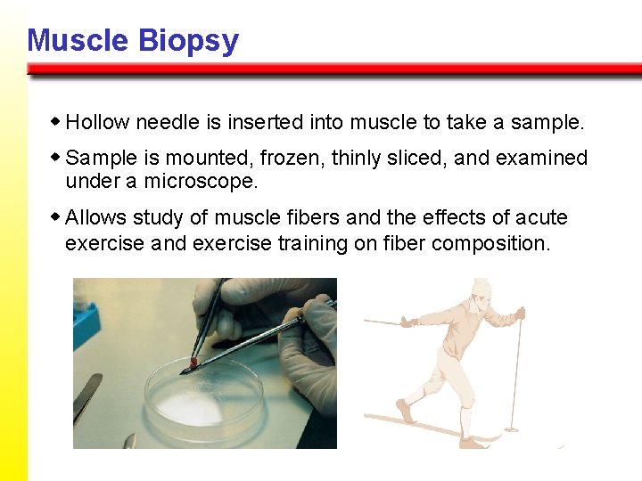 Muscle Biopsy w Hollow needle is inserted into muscle to take a sample. w