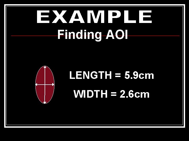 Finding AOI LENGTH = 5. 9 cm WIDTH = 2. 6 cm 