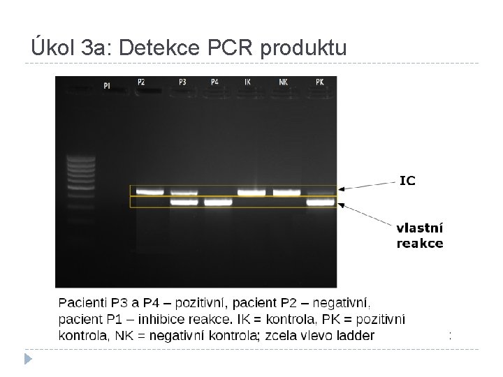 Úkol 3 a: Detekce PCR produktu 